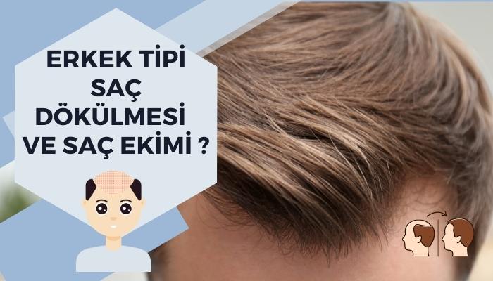 Erkek Tipi Saç Dökülmesi ve Saç Ekimi