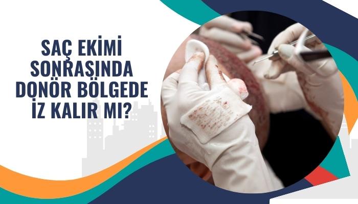 Saç Alınan Donör Bölgede İz Kalır Mı?