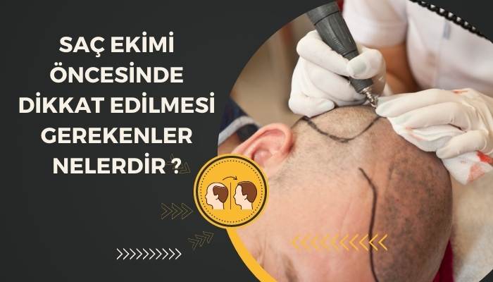 Saç Ekimi Öncesinde Dikkat Edilmesi Gerekenler Nelerdir?