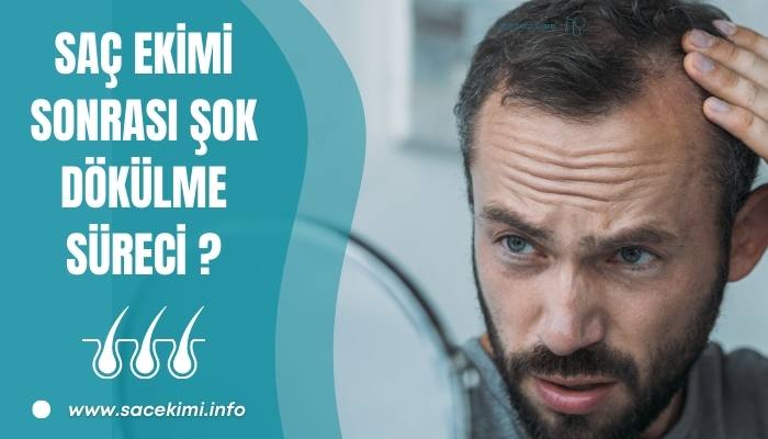 Saç Ekimi Sonrası Şok Dökülme Süreci Nasıl Geçer