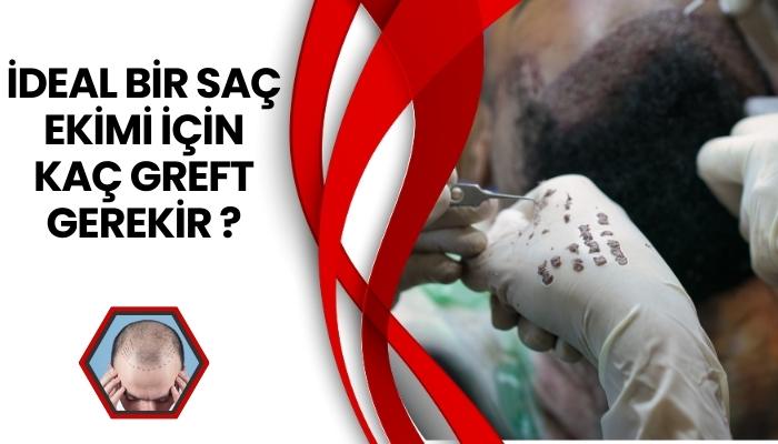 İdeal Saç Ekimi İçin Kaç Greft Gerekir?